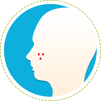 Acne Vulgaris - Sol–gel Process (353x353)
