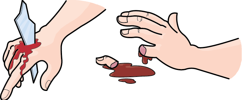 Uncontrolled Bleeding - Cartoon Bleeding (773x320)