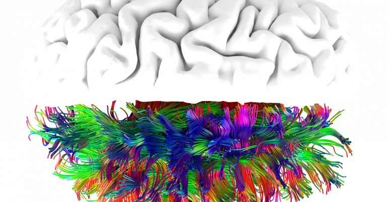 Seeing The Brain - Illustration (770x400)