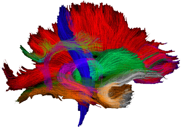 Post Processing Will Be Performed With Freesurfer, - Neuroimaging (646x462)