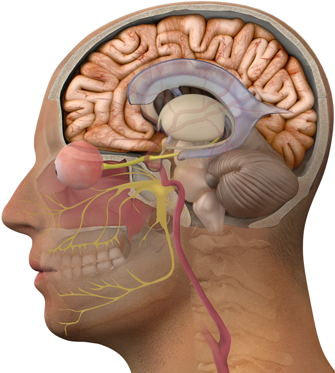 Brain Tumor - Brain Tumor (675x750)