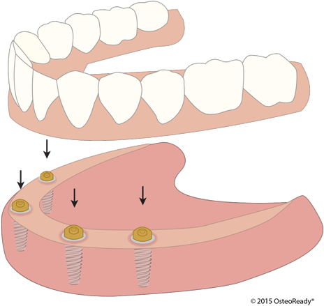 Illustration (500x441)