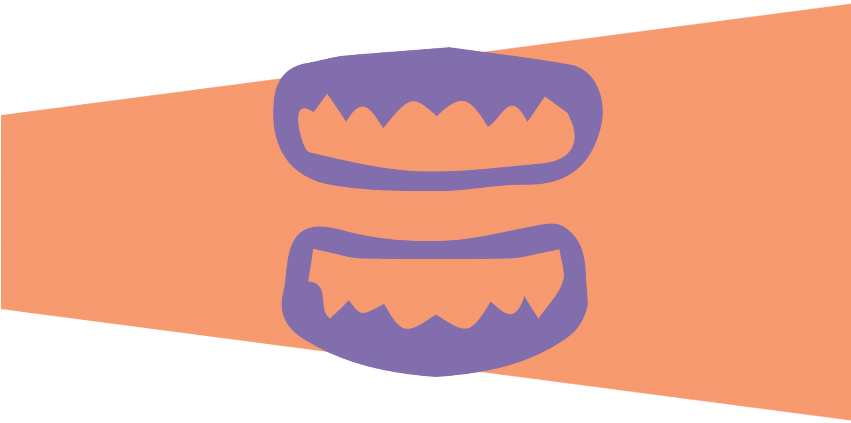 Dentures (850x467)