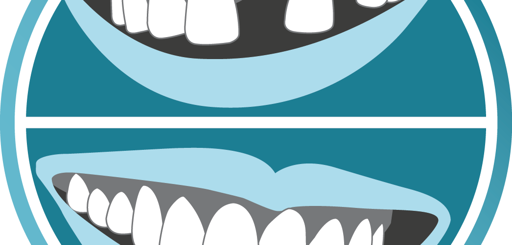 Dental Implants A Super Solution For Missing Teeth - Dental Implants A Super Solution For Missing Teeth (1046x502)