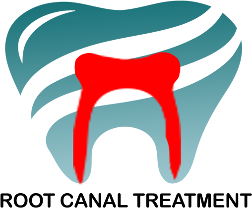 Our Dental Services - Tonsillolith (664x454)