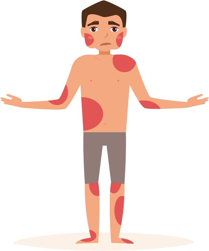 Eczema - Cartoon (817x981)