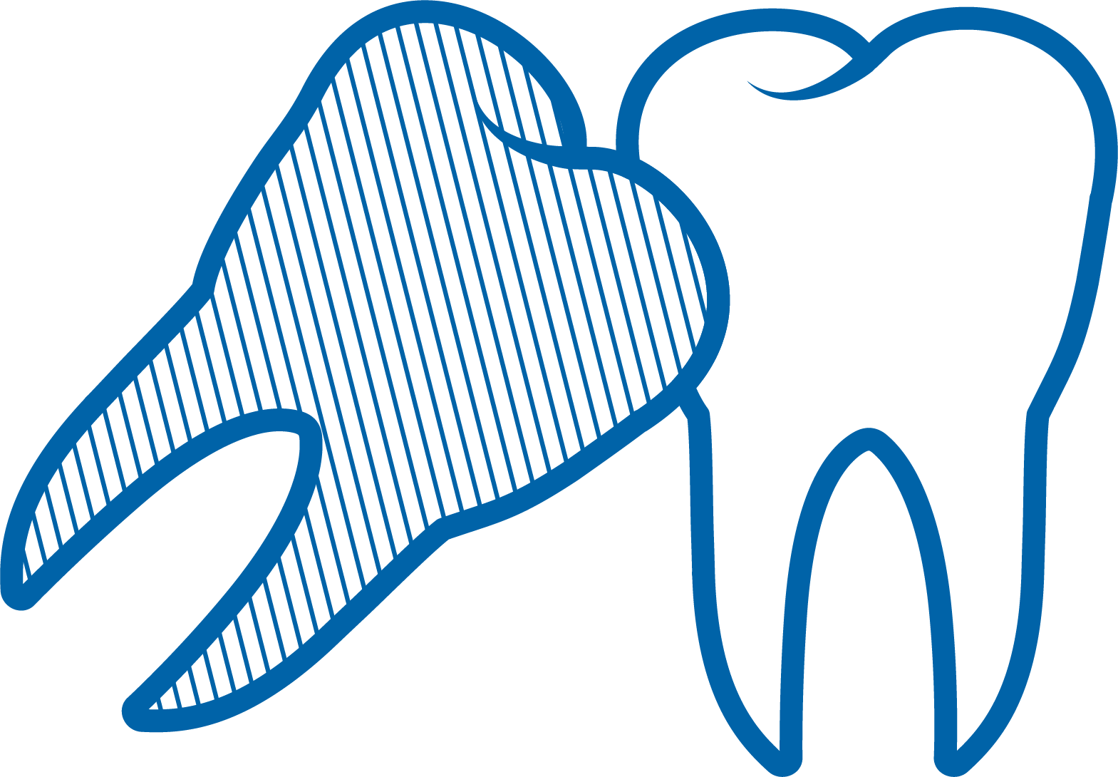 Wisdom Tooth Removal - Wisdom Tooth Removal (1569x1090)
