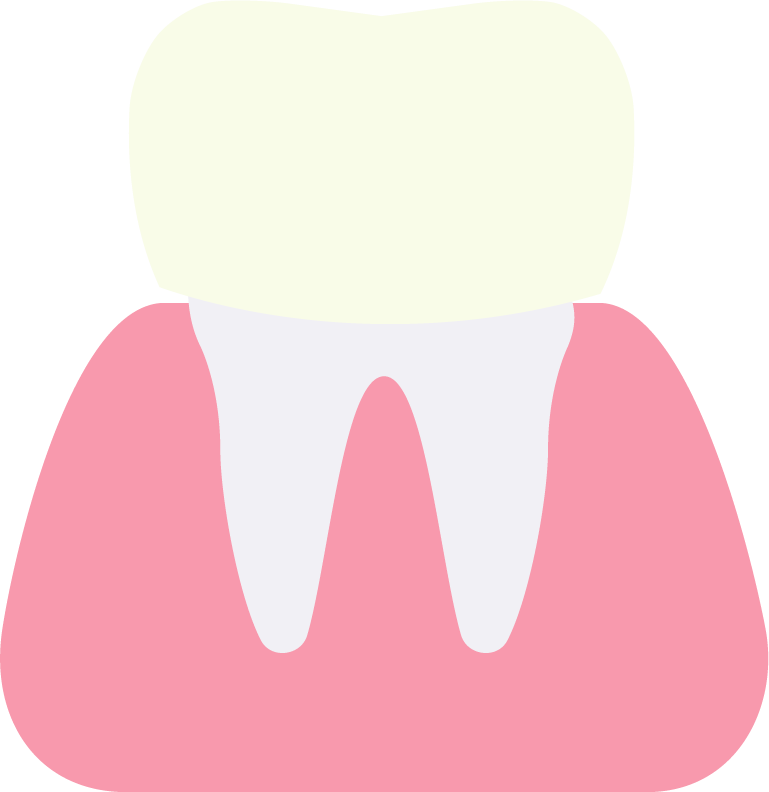 Dental Crowns - Crown (769x792)