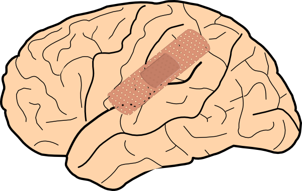 Brain Injury Clipart Clip Art At Clker Com Vector Online - Brain Damage Clipart (600x381)