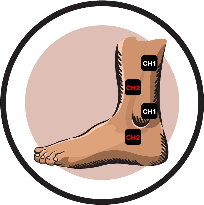 Ankle Tens Unit Placement (724x724)