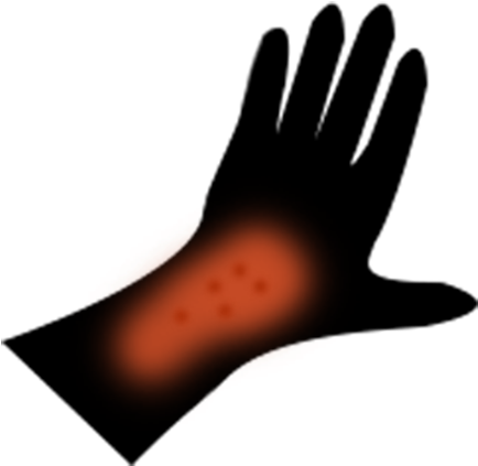 Rashes - Illustration (500x500)