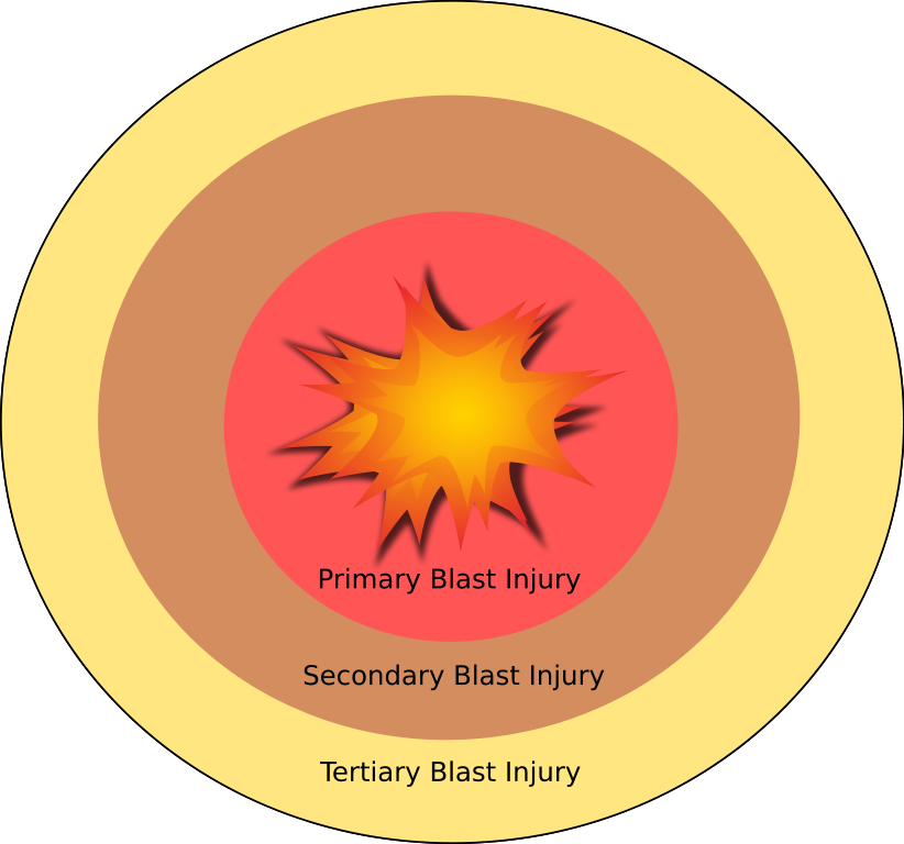 Explosion Blast Injury Explosive Material Blast Wave - Explosion Blast Injury Explosive Material Blast Wave (822x768)