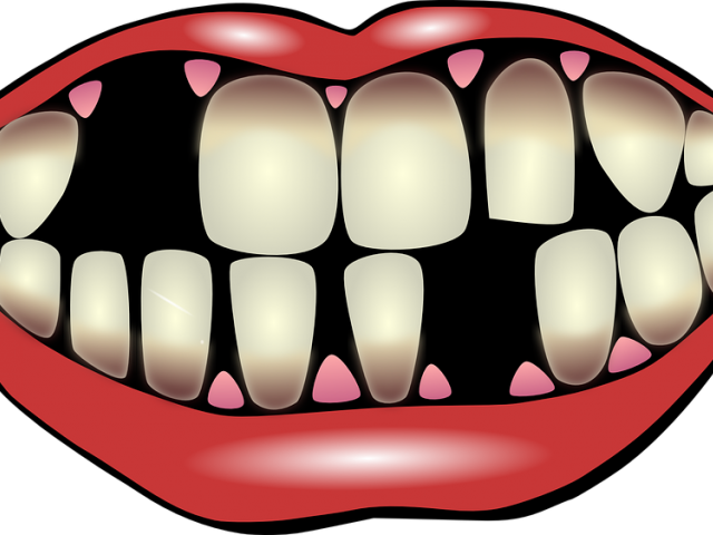 Loose Tooth Cliparts - Cause And Effect Visual Cards (640x480)