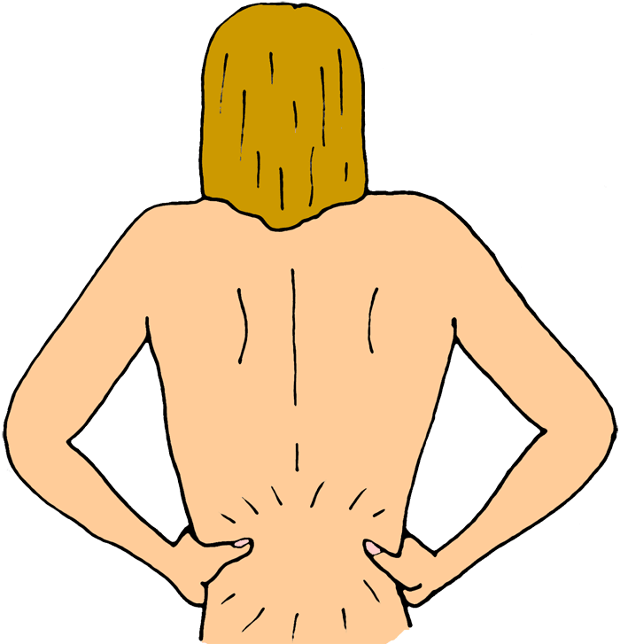 Backache Clipart - Backache Clip Art (700x727)