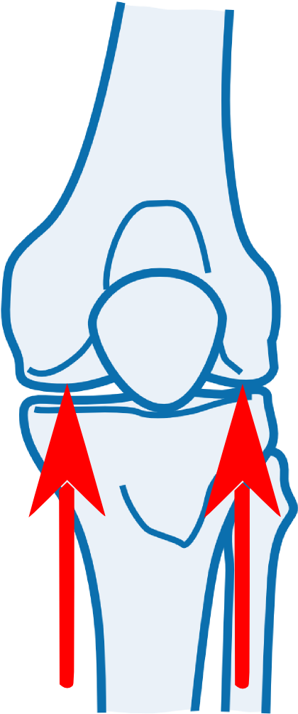 Knee Joint Orthopaedic Testing - Orthopedic Surgery (469x1064)