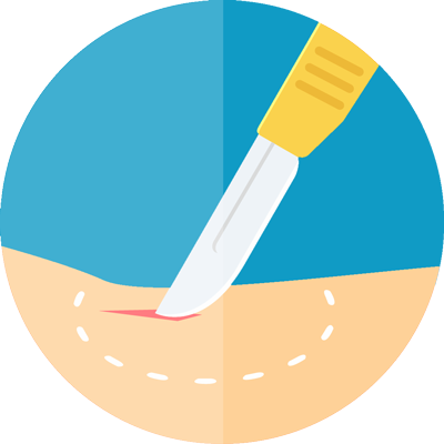 Skin And Tissue Surgery - Surgery (400x400)