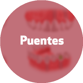 Nuestros Tratamientos - Circle (350x350)