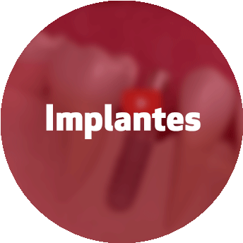 Nuestros Tratamientos - Circle (350x350)