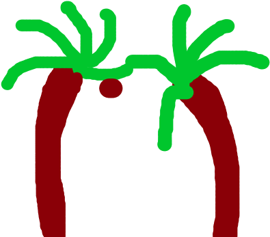 Palm Tree Deforestation - Deforestation (500x400)
