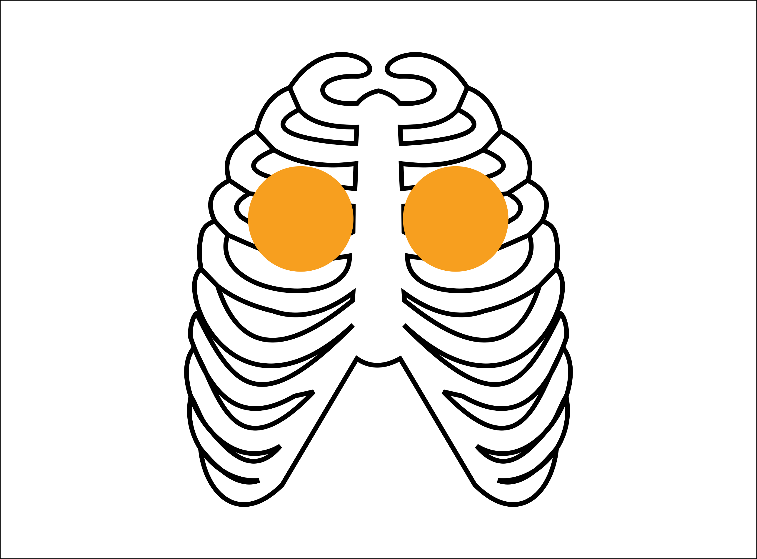 Copd - Copd (2574x1900)