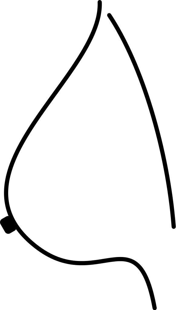 File - Breast Lateral - Svg - Wikimedia Commons (582x1024)
