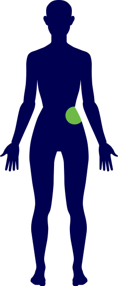 Hip - Promet Physical Therapy, Pc (238x577)