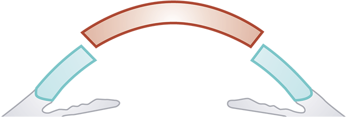 Pkp - Arch (705x239)