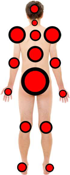 Systemic Disease - Systemic Disease (257x601)
