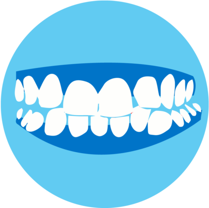 Create More Space For Crowded Teeth - Create More Space For Crowded Teeth (512x427)
