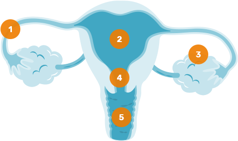 Fallopian Tube / - Fallopian Tube / (651x360)