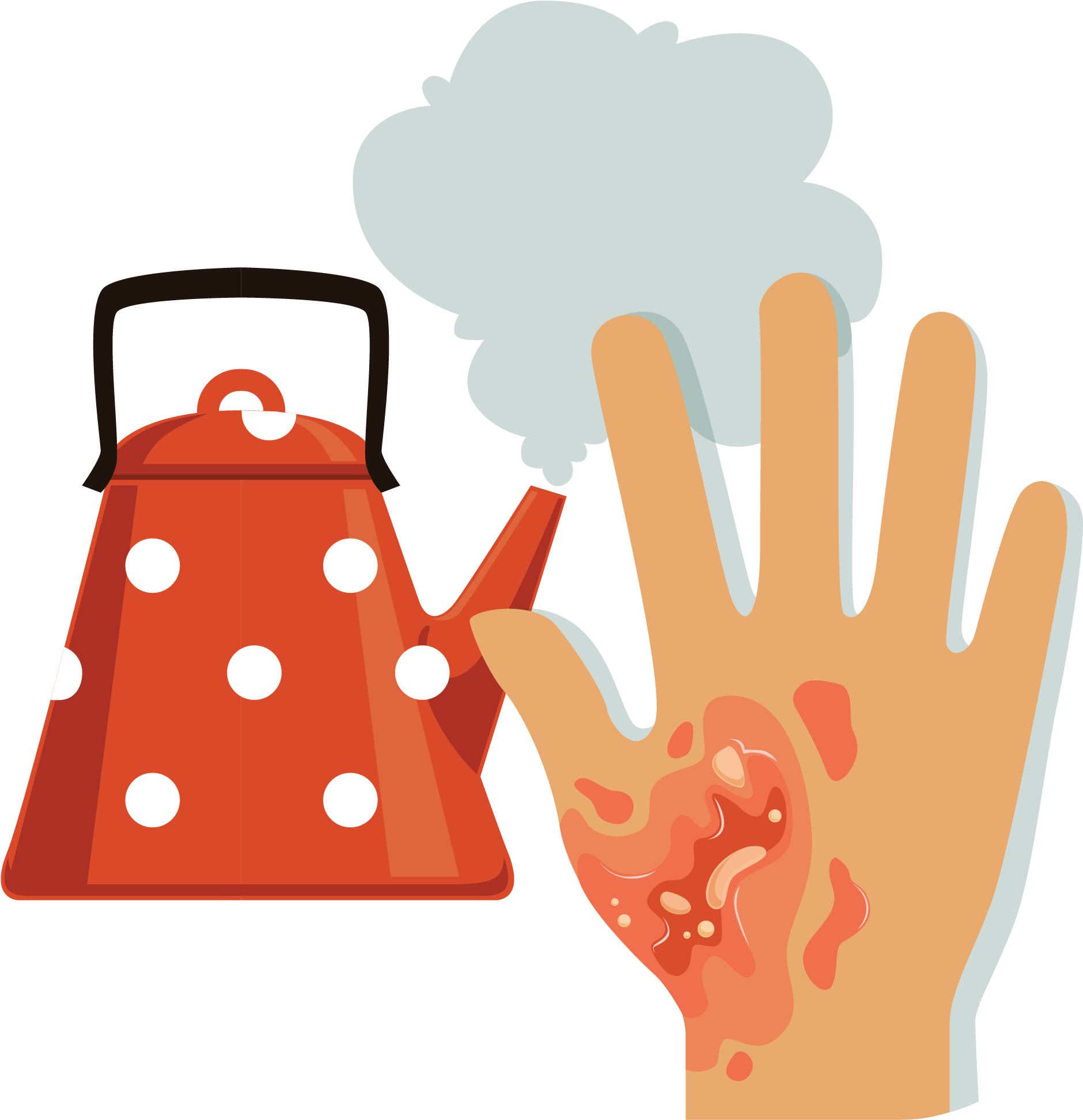Heat Burn-01 - Burn Hand Vector (3508x2480)