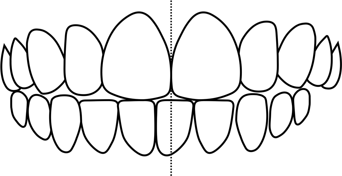 Crooked Teeth - Crooked Teeth (1200x622)