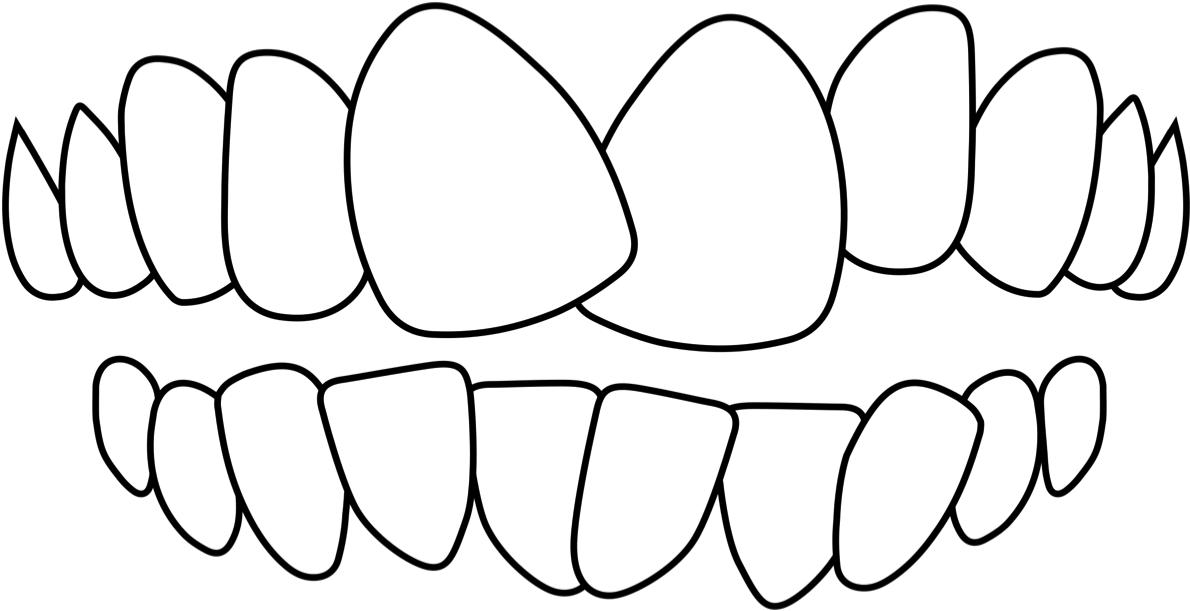 Crooked Teeth - Crooked Teeth (1200x622)