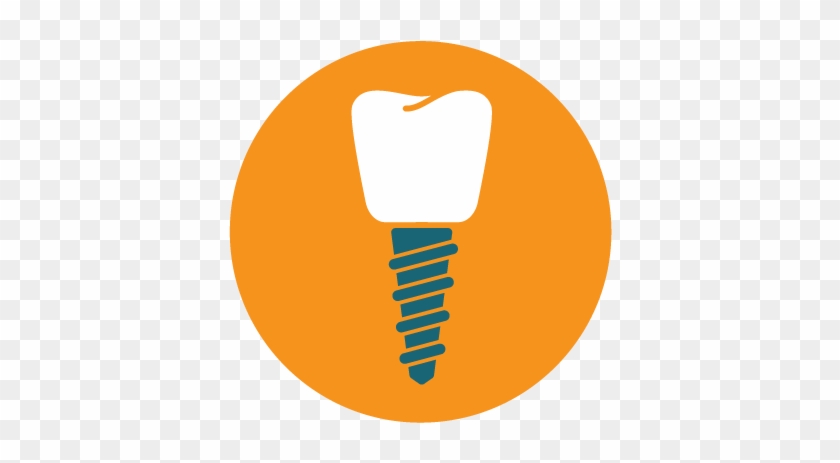 Dental Implants - Dentistry #494405