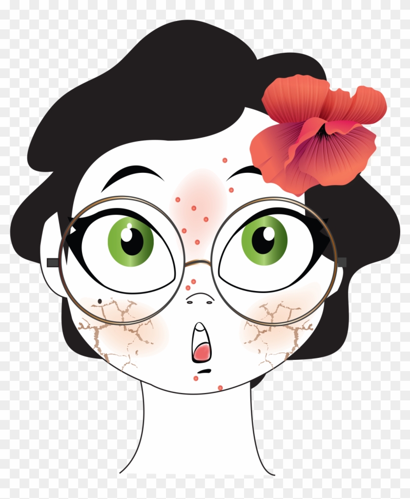 Skin #501133