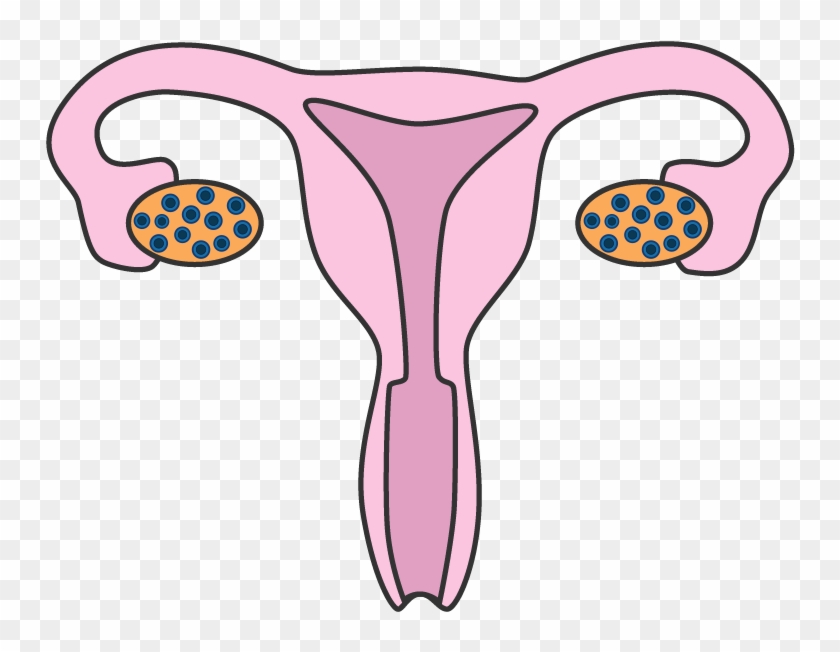 Pcos V1 - Naturopathy #501321