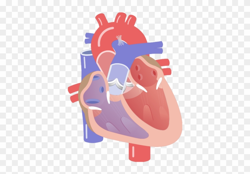 Movement Of The Heart Valves Animation Slide - Cardiac Conduction System Unlabeled #100110