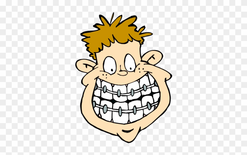 Braces Cliparts - Braces Cartoon #554050
