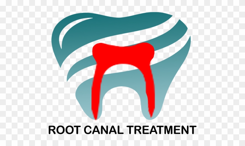 Our Dental Services - Tonsillolith #563347