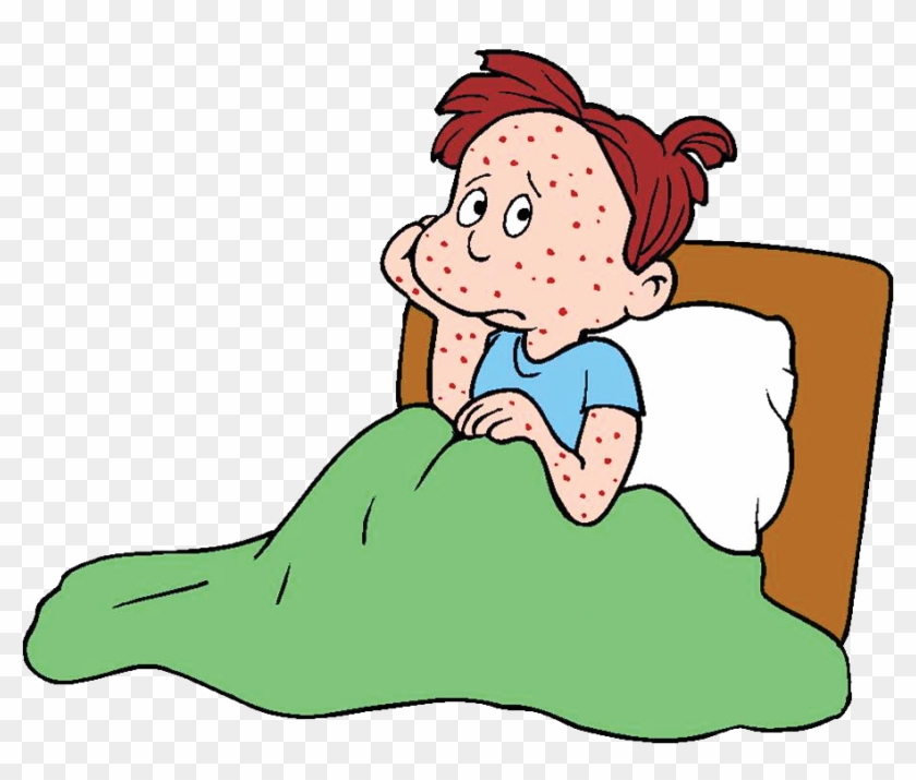 Chicken Pox Clipart #628850