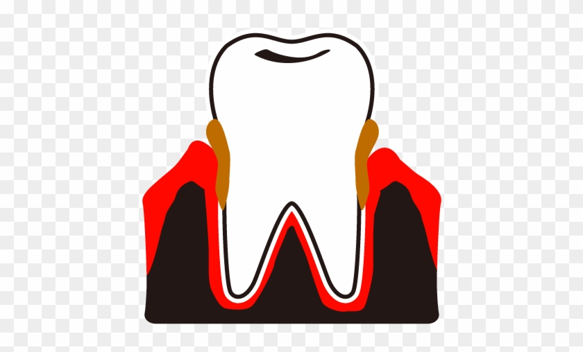 View All Images-1 - Dental Plaque Clip Art #633425