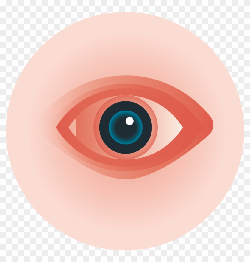Pink Eyes Clipart Itchy Eye - Swollen Eyes Clipart #656719