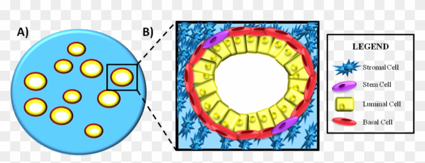 A) Simplistic View Of The Prostate Gland Structure - Stromal And Epithelial Cells Of Prostate #684060