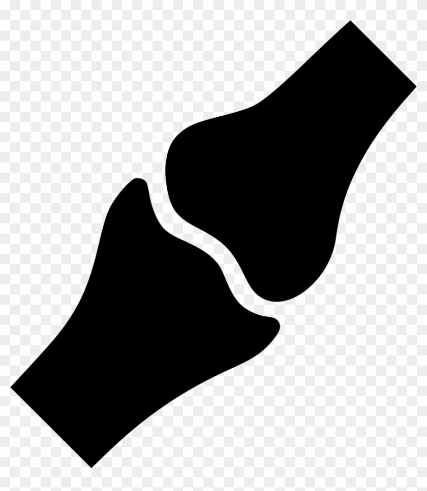 Joint Pain Bone Computer Icons Clip Art - Joint Bone Icon Png #714834