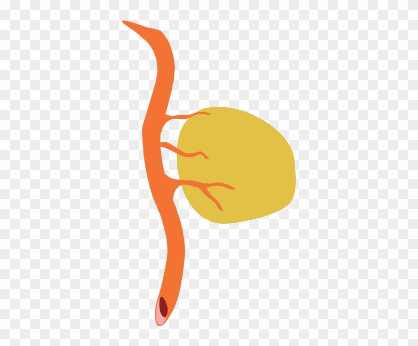 To Survive And Grow, Tumors Require Oxygen And Nutrients - To Survive And Grow, Tumors Require Oxygen And Nutrients #718519