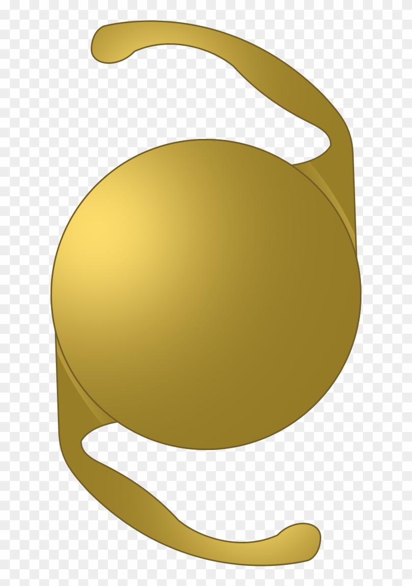 Toric Lenses - Illustration #739674