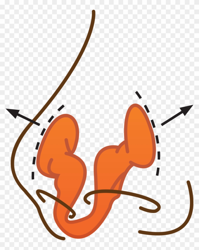 Orangedevicenose - Illustration #772892
