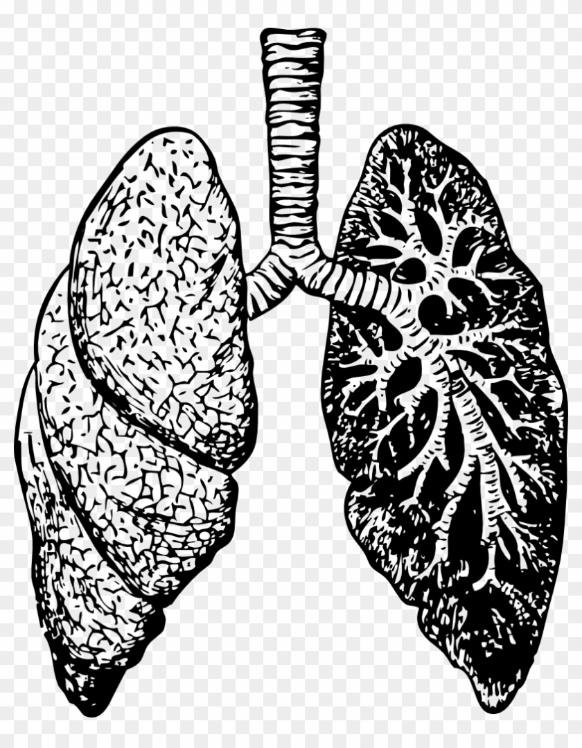 Lungs - Dealing With Bronchitis: Overcoming Bronchitis And #775672