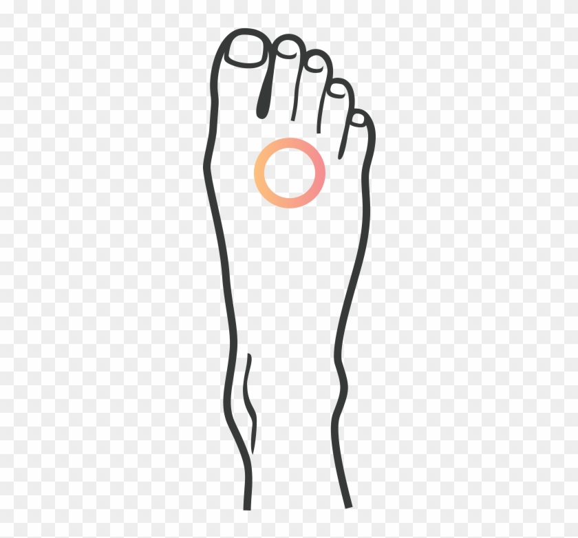 Neuroma - Neuroma #776843