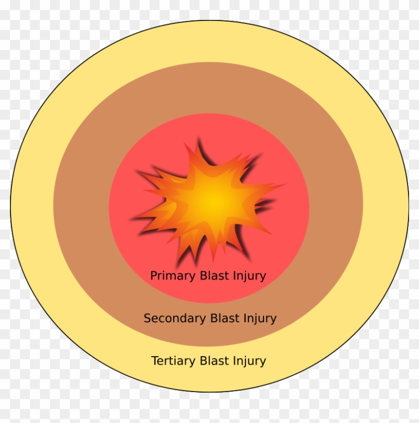 Explosion Blast Injury Explosive Material Blast Wave - Explosion Blast Injury Explosive Material Blast Wave #805683